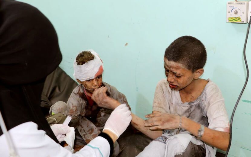 Suudi Arabistan Yemen’de Çocukları Vurdu: 50 Ölü