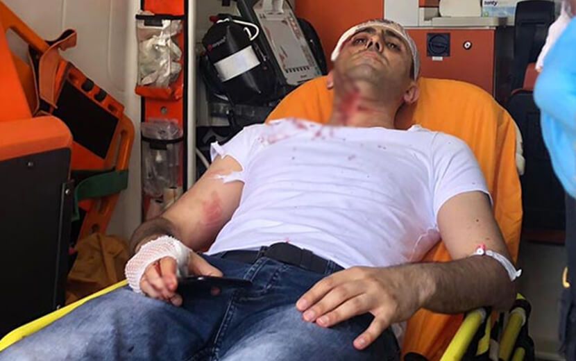 Akit TV Haber Müdürü Murat Alan’a Saldırı
