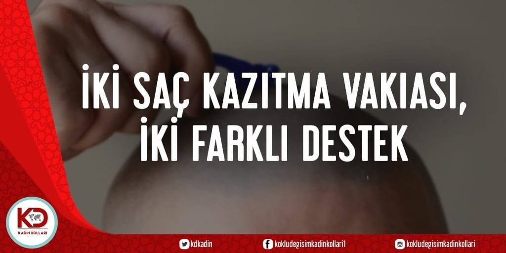 İKİ SAÇ KAZITMA VAKIASI, İKİ FARKLI DESTEK